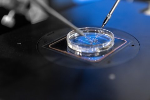 Künstliche Befruchtung in der Petrischale 